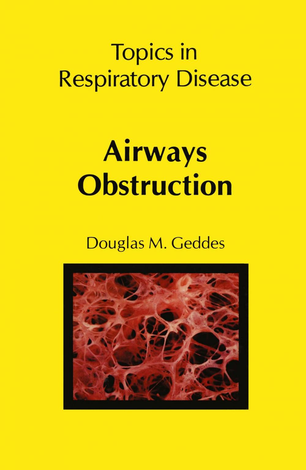 Big bigCover of Airways Obstruction