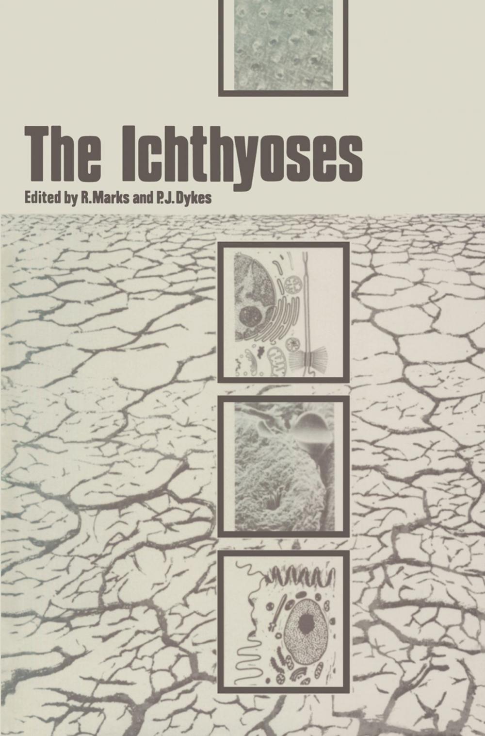 Big bigCover of The Ichthyoses
