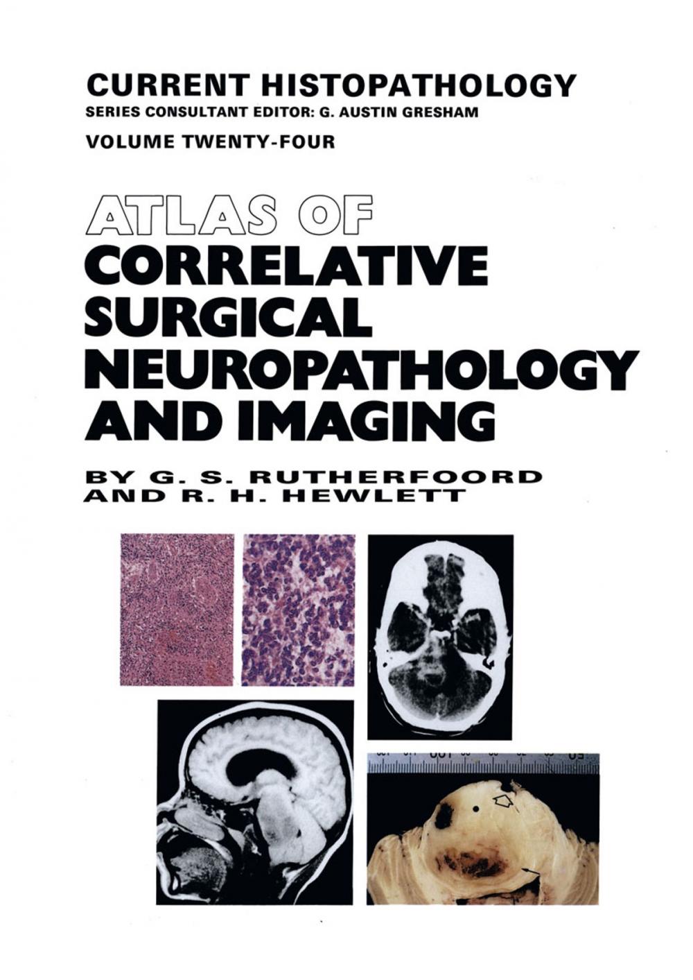 Big bigCover of Atlas of Correlative Surgical Neuropathology and Imaging