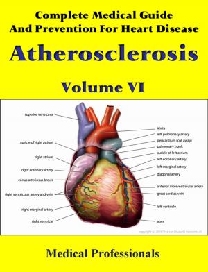 Cover of Complete Medical Guide and Prevention for Heart Diseases Volume VI; Atherosclerosis