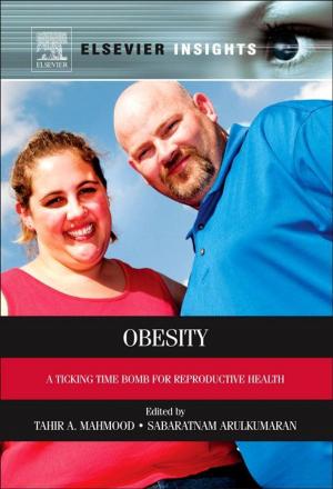 Cover of the book Obesity by Ljubivoje M. Popovic