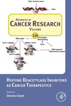 Cover of the book Histone Deacetylase Inhibitors as Cancer Therapeutics by Karen Holtzblatt, Jessamyn Burns Wendell, Shelley Wood