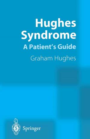 Cover of the book Hughes Syndrome by Y Zhao, T Kramer, Robert Brown, Xun Xu
