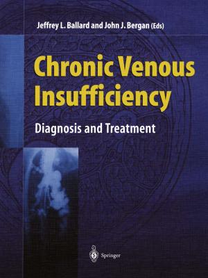 Cover of the book Chronic Venous Insufficiency by Belkacem Ould Bouamama, Arun Kumar Samantaray, Pushparaj Mani Pathak, Rochdi Merzouki