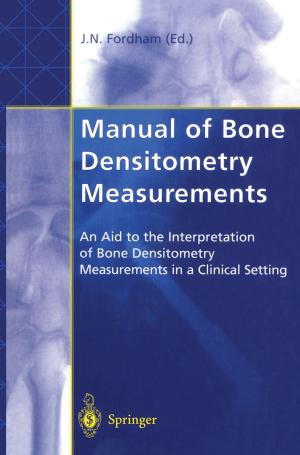 Cover of the book Manual of Bone Densitometry Measurements by Marius Paulescu, Eugenia Paulescu, Paul Gravila, Viorel Badescu
