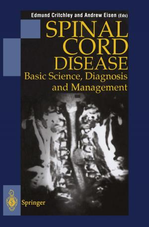 Cover of the book Spinal Cord Disease by D.N.Prabhakar Murthy, Nat Jack