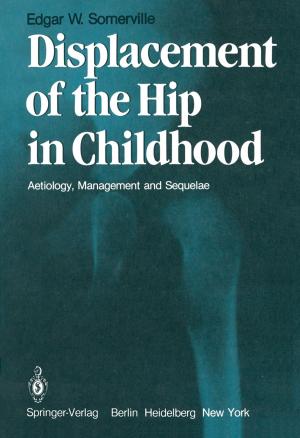 Cover of the book Displacement of the Hip in Childhood by Alan J. Sangster