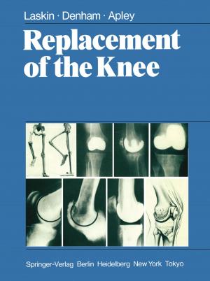 Book cover of Replacement of the Knee