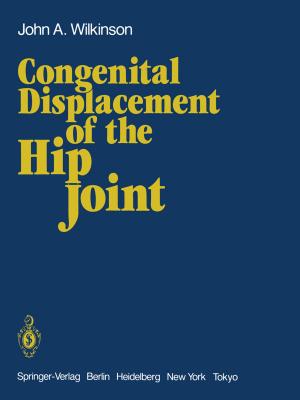 Cover of the book Congenital Displacement of the Hip Joint by Fiona Campbell, Caroline S. Verbeke
