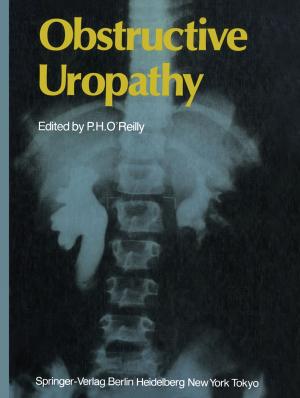 Cover of the book Obstructive Uropathy by Anthony G. Gallagher, Gerald C. O'Sullivan