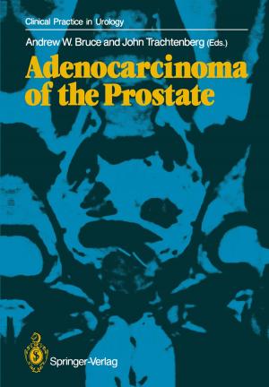 Cover of the book Adenocarcinoma of the Prostate by R.A. Audisio, H.S. Stoldt