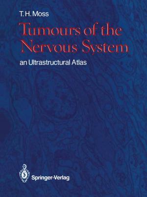 Book cover of Tumours of the Nervous System