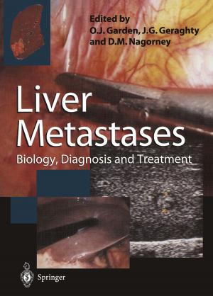 Cover of the book Liver Metastases by 