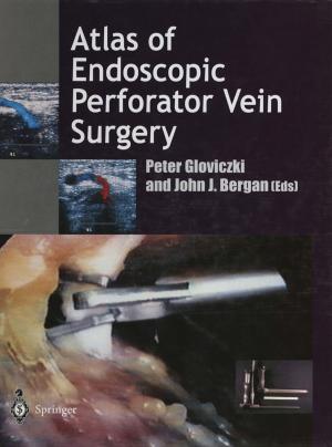 Cover of the book Atlas of Endoscopic Perforator Vein Surgery by J.L. Gwinn, P. Stanley