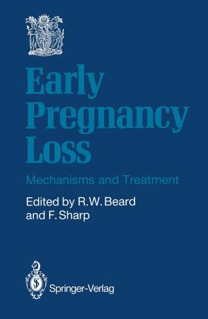 Cover of the book Early Pregnancy Loss by Zhijun Li, Chenguang Yang, Liping Fan