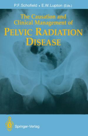 bigCover of the book The Causation and Clinical Management of Pelvic Radiation Disease by 