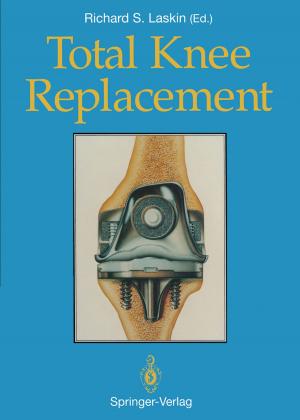 Book cover of Total Knee Replacement