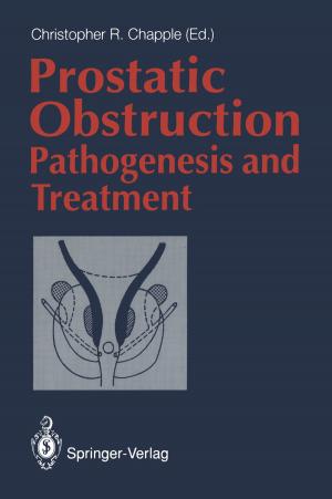 Cover of the book Prostatic Obstruction by J.F. Jensen, E. Kjems, N. Lehmann, C. Madsen