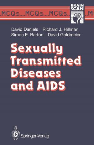 Book cover of Sexually Transmitted Diseases and AIDS