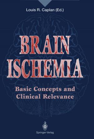 Cover of the book Brain Ischemia by Tshilidzi Marwala, Monica Lagazio
