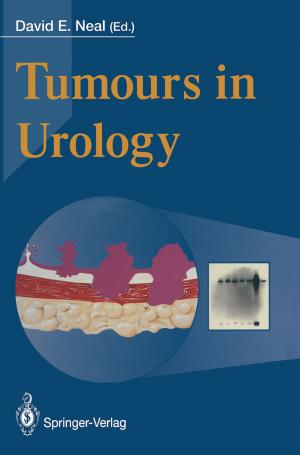 Cover of the book Tumours in Urology by Clay Cockerell, Cary Chisholm, Chad Jessup, Martin C. Mihm Jr., Brian J. Hall, Margaret Merola