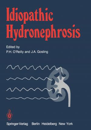 Cover of the book Idiopathic Hydronephrosis by Sanjay Goel, Yuan Hong, Vagelis Papakonstantinou, Dariusz Kloza