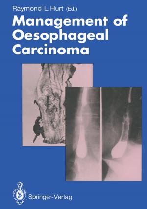 Cover of the book Management of Oesophageal Carcinoma by Israël César Lerman