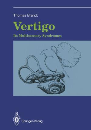Cover of the book Vertigo: Its Multisensory Syndromes by Morris F. Collen