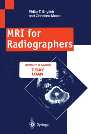 Cover of the book MRI for Radiographers by Akira Maruoka