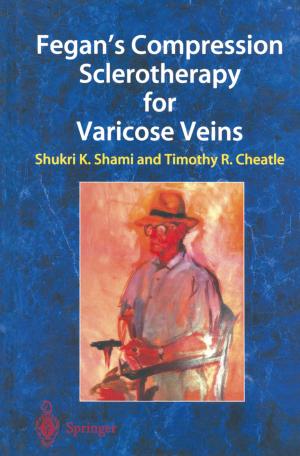Cover of the book Fegan’s Compression Sclerotherapy for Varicose Veins by Zude Zhou, Dejun Chen, Shane (Shengquan) Xie