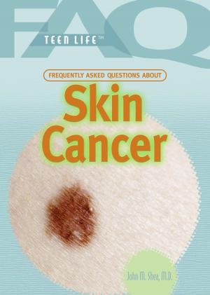 Cover of the book Frequently Asked Questions About Skin Cancer by Brian Wingate, Jeremy Cooperson