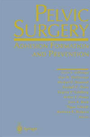 Cover of the book Pelvic Surgery by Jaap E. Wieringa, Koen H. Pauwels, Peter S.H. Leeflang, Tammo H.A. Bijmolt