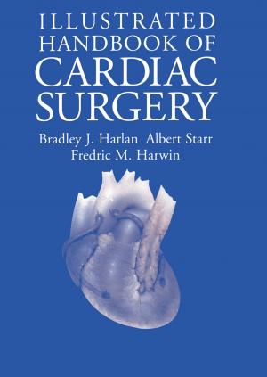 Cover of the book Illustrated Handbook of Cardiac Surgery by Paul Montagna, Terence A. Palmer, Jennifer Beseres Pollack