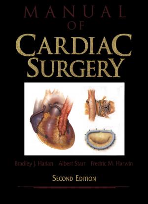 Cover of the book Manual of Cardiac Surgery by Mark J. Jackson, Michael P. Hitchiner