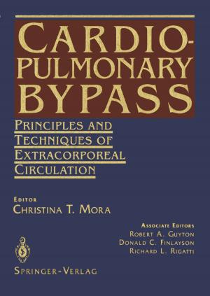 Cover of the book Cardiopulmonary Bypass by Stephen O. Dean