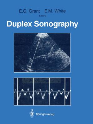 Cover of the book Duplex Sonography by John H. Holliman