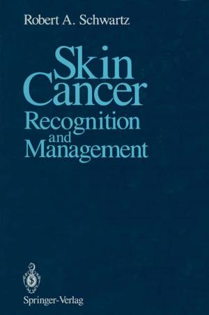 Cover of the book Skin Cancer by Alexander Kolker