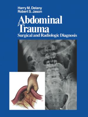 Cover of the book Abdominal Trauma by T. Nasemann, W. Sauerbrey, W.H.C. Burgdorf
