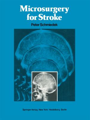 Cover of the book Microsurgery for Stroke by Michael J. Gonzalez, Jorge R. Miranda-Massari