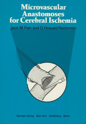 Cover of the book Microvascular Anastomoses for Cerebral Ischemia by William Paolini