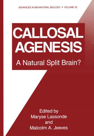 Cover of the book Callosal Agenesis by M.P. Feldman, Albert N. Link, Donald S. Siegel