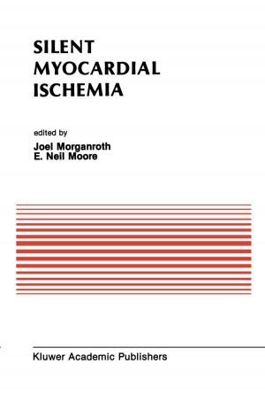 Cover of the book Silent Myocardial Ischemia by Terence J. McKnight, Alison L. Kitson, James M. Brown