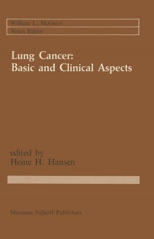Cover of the book Lung Cancer: Basic and Clinical Aspects by Kai Qian, Li Cao, David Den Haring