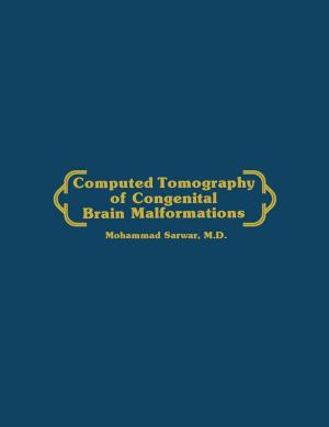 Cover of the book Computed Tomography of Congenital Brain Malformations by Thomas L. Leaman