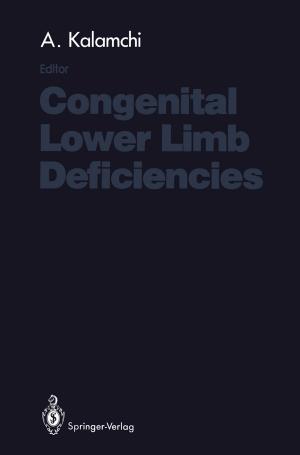 Cover of the book Congenital Lower Limb Deficiencies by B.A. Bolt, W.L. Horn, G.A. MacDonald, R.F. Scott