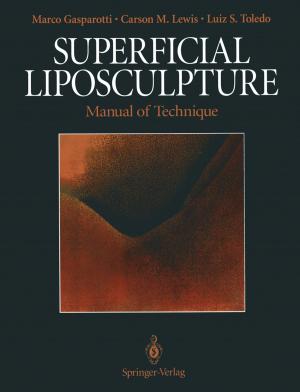 Cover of the book Superficial Liposculpture by Daniel J. Ozer