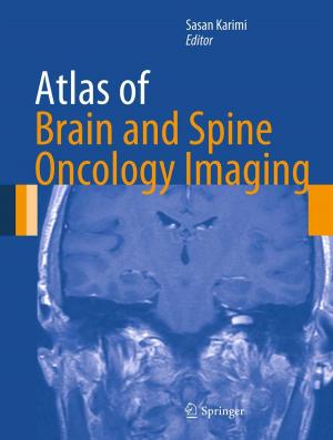 Cover of the book Atlas of Brain and Spine Oncology Imaging by D.A. Klyushin, S.I. Lyashko, D.A. Nomirovskii, Yu.I. Petunin, Vladimir Semenov