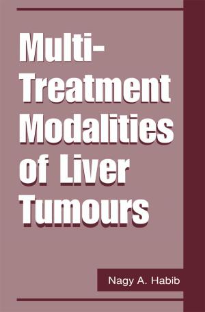 Cover of the book Multi-Treatment Modalities of Liver Tumours by 