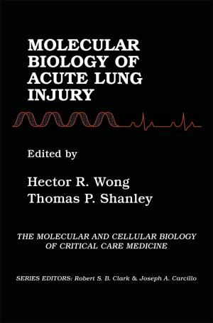 Cover of the book Molecular Biology of Acute Lung Injury by Ralph Early