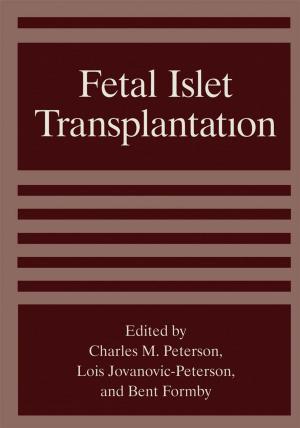 Cover of the book Fetal Islet Transplantation by T. Agami Reddy